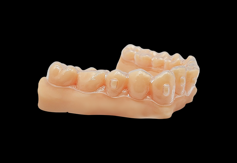 什么是3d打印正畸牙模？3d打印正畸牙模怎么做？